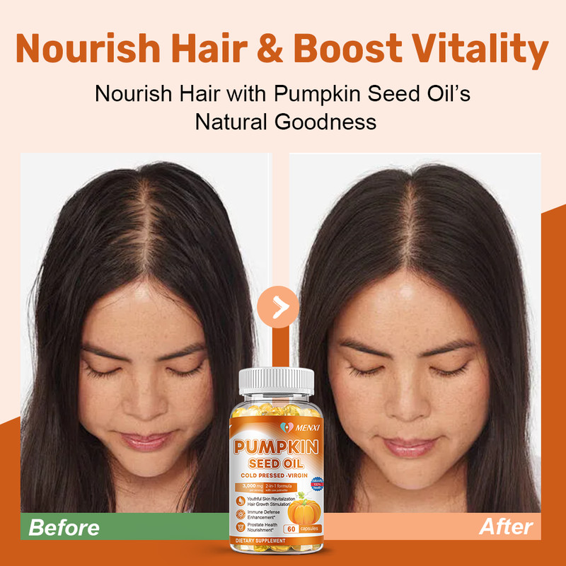 Pumpkin Seed Oil 3000mg Capsule | Prostate Health | Immune Function 120 Softgels gallery