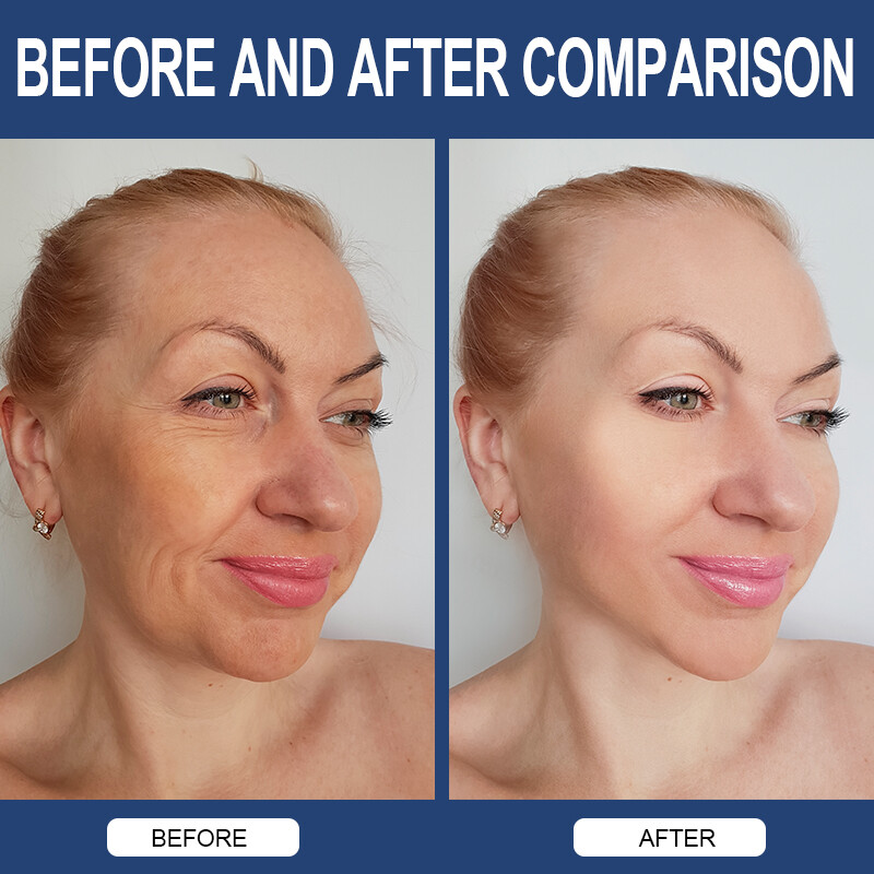 Collagen Hyaluronic Acid Vitamin C Capsules AntiAging Wrinkles Skin Joint Health gallery