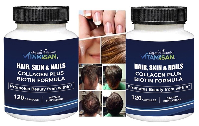 Vitamins Collagen Biotin GROWTH HERBAL PILLS PREVENT ANTI LOSS support