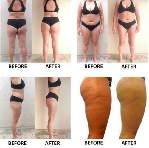 PURE KETO + BHB Weight Loss Slim Pills Fat -1200mg-Supplements CAPSULES gallery